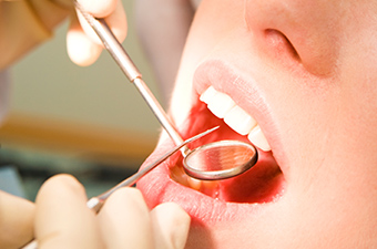 どうして予防歯科が必要なの？